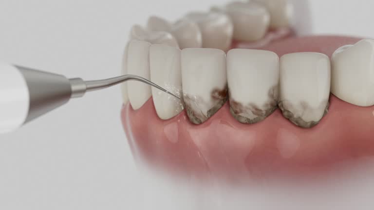 Trusted Invisalign Clear Aligners service in Millersburg, OH - Dentist Open Now